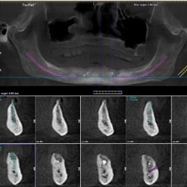 dentisti associati cassino (Frosinone) scanner